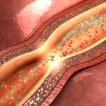 L-Arginin und seine Bedeutung für die Gefäßgesundheit